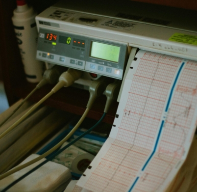 Close-up of an ECG machine displaying heart rate results in a hospital setting.