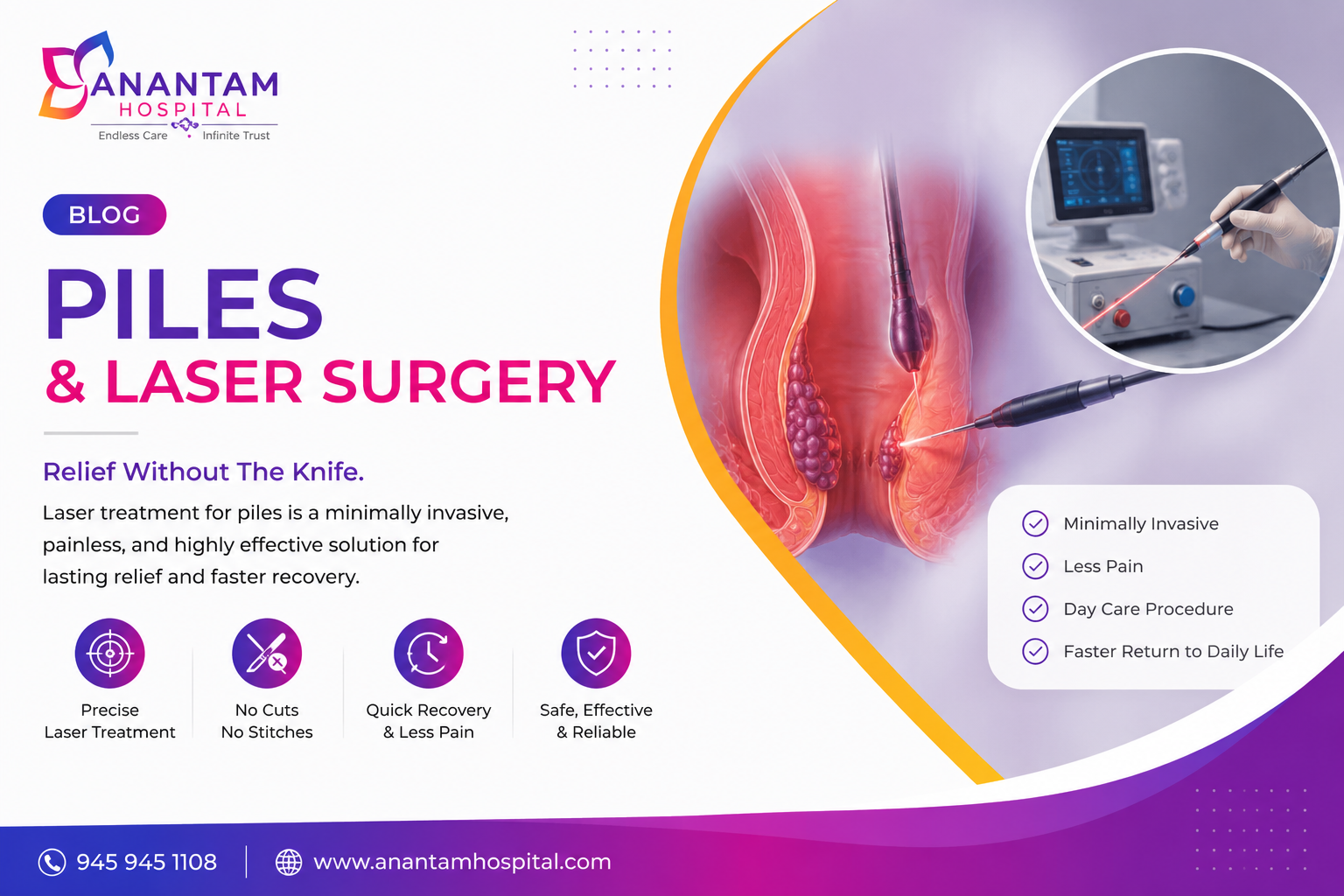Piles and Laser Treatment at Anantam Hospital